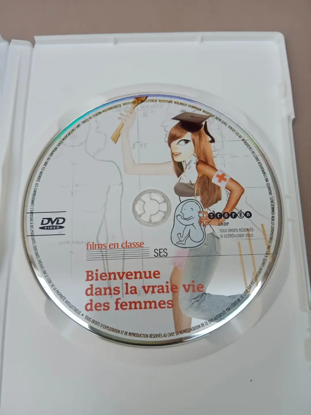 Don n°2